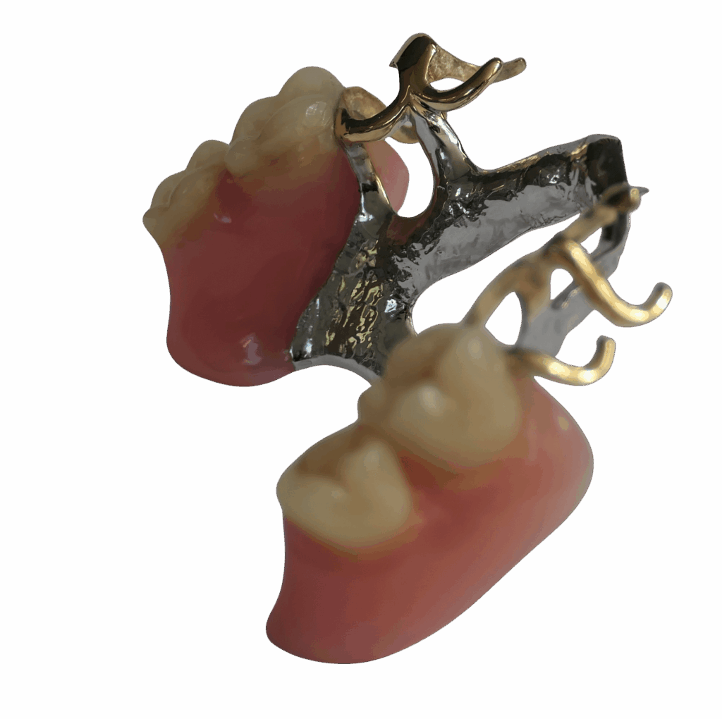Frame bovenkaak 2 - Van Loenen Tandtechniek
