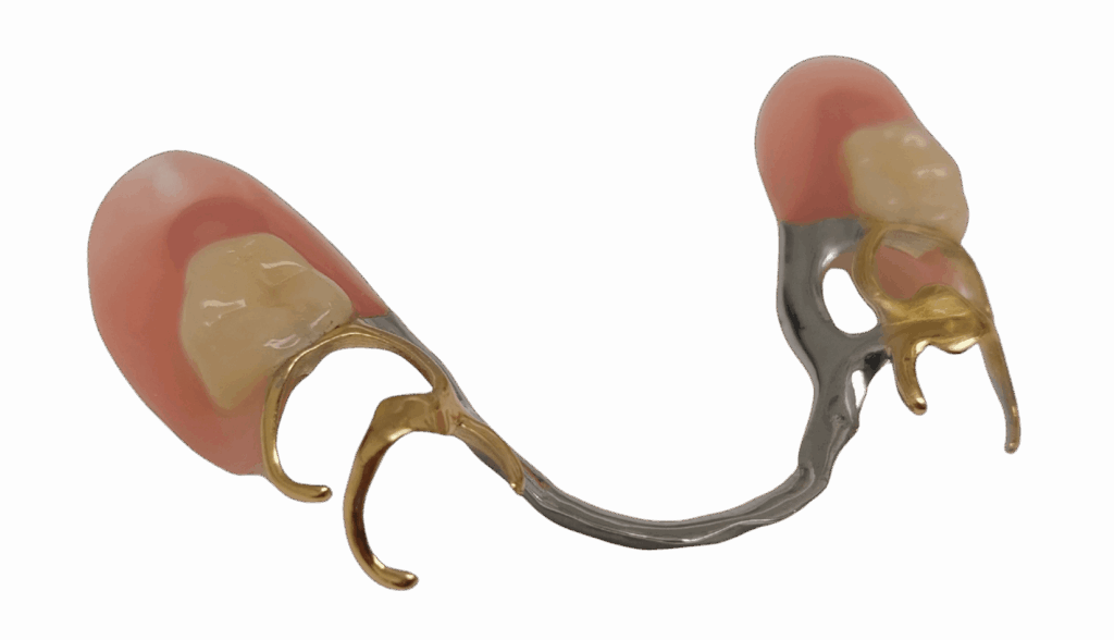 Frame onderkaak - Van Loenen Tandtechniek