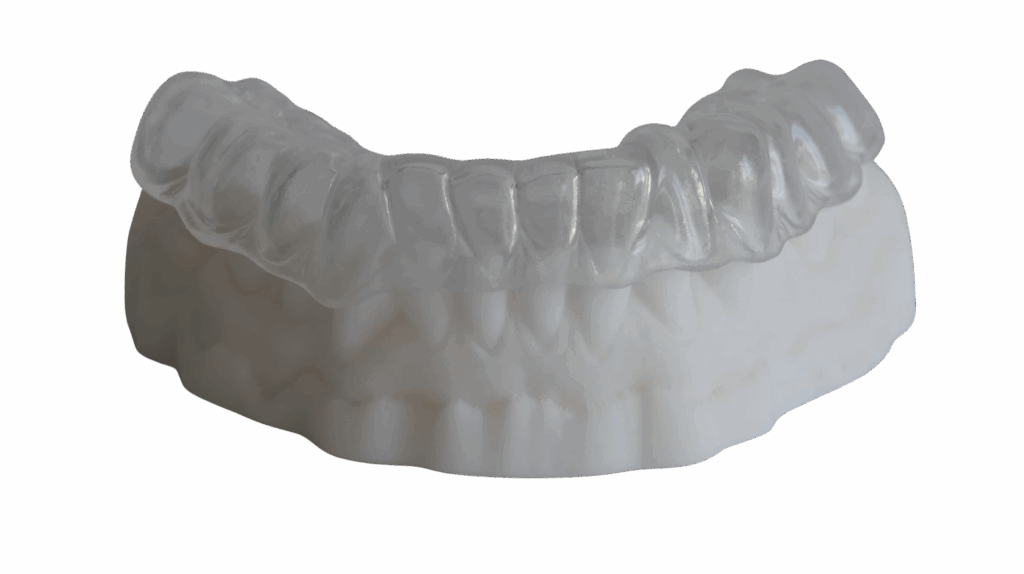 Zacht knarsbitje - Van Loenen Tandtechniek